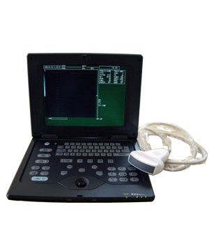 Palmsize laptop b-ultrasound scanner&3.5MHZCONVEX probe