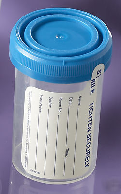 O.r. pneumatic tube system specimen container sterile