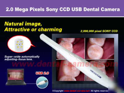 New 2.0 m pixels sony ccd usb dental intraoral camera