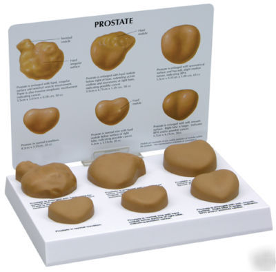 New brand prostate model
