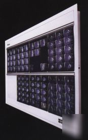 Wolf x-ray liberator viewbox illuminator, 4 bulb,