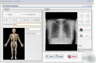Digital x-ray for urgent care, vet, and chiropractic
