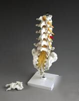 Vertebral column, lumbar w herniated disc lfa # 2310 #