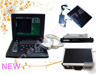 New digital notebook laptop ultrasound scanner w usb, 