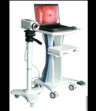New brand digital video electronic colposcope+software