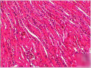 Advanced monocular microscope. 4X, 10X, 40XR, 100XR.