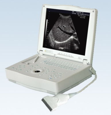 New laptop ultrasound machine/scannerâ€‹/system w convex