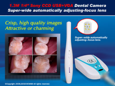 1.3M sony ccd high resolution dental intraoral camera s