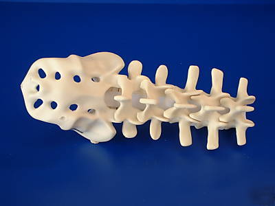 New spine lumbar-sacral L1/sacrum foam lfa #2350A 