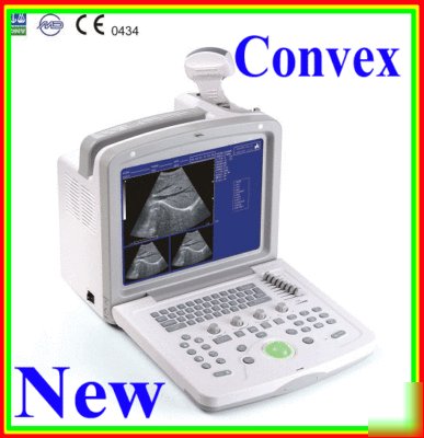Full digital ultrasound scanner with convex probe 2 usb